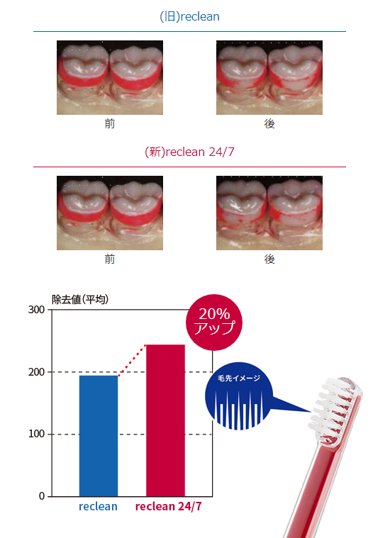Amazon.co.jp: reclean 24/7 リクリーン 超音波歯ブラシ（WHITE